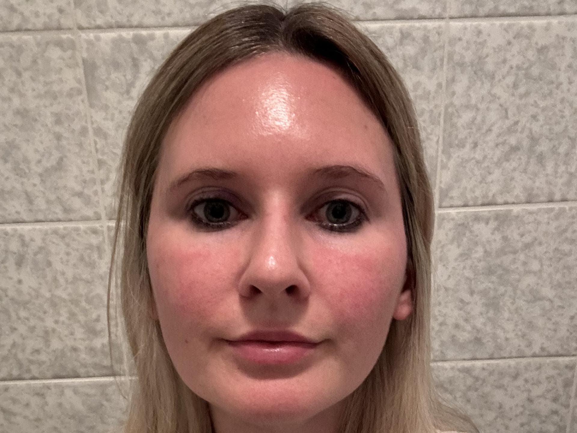 Gesicht vor der Gua Sha Massage Gesicht vor der Gua Sha Massage
