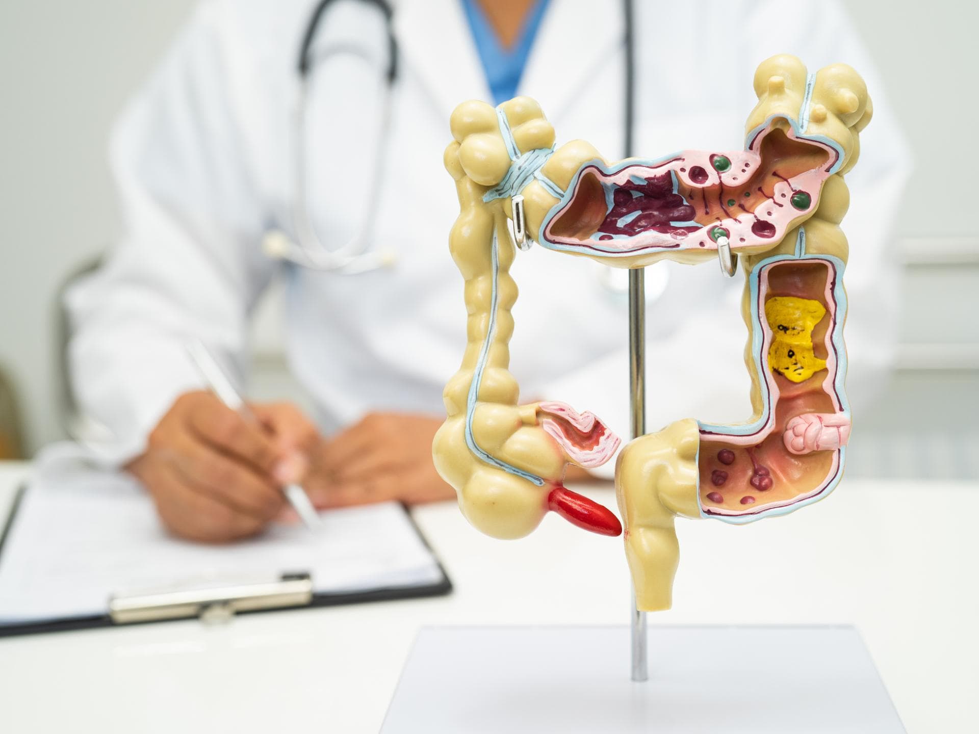 Arzt sitzt vor anatomischem Modell des Darms