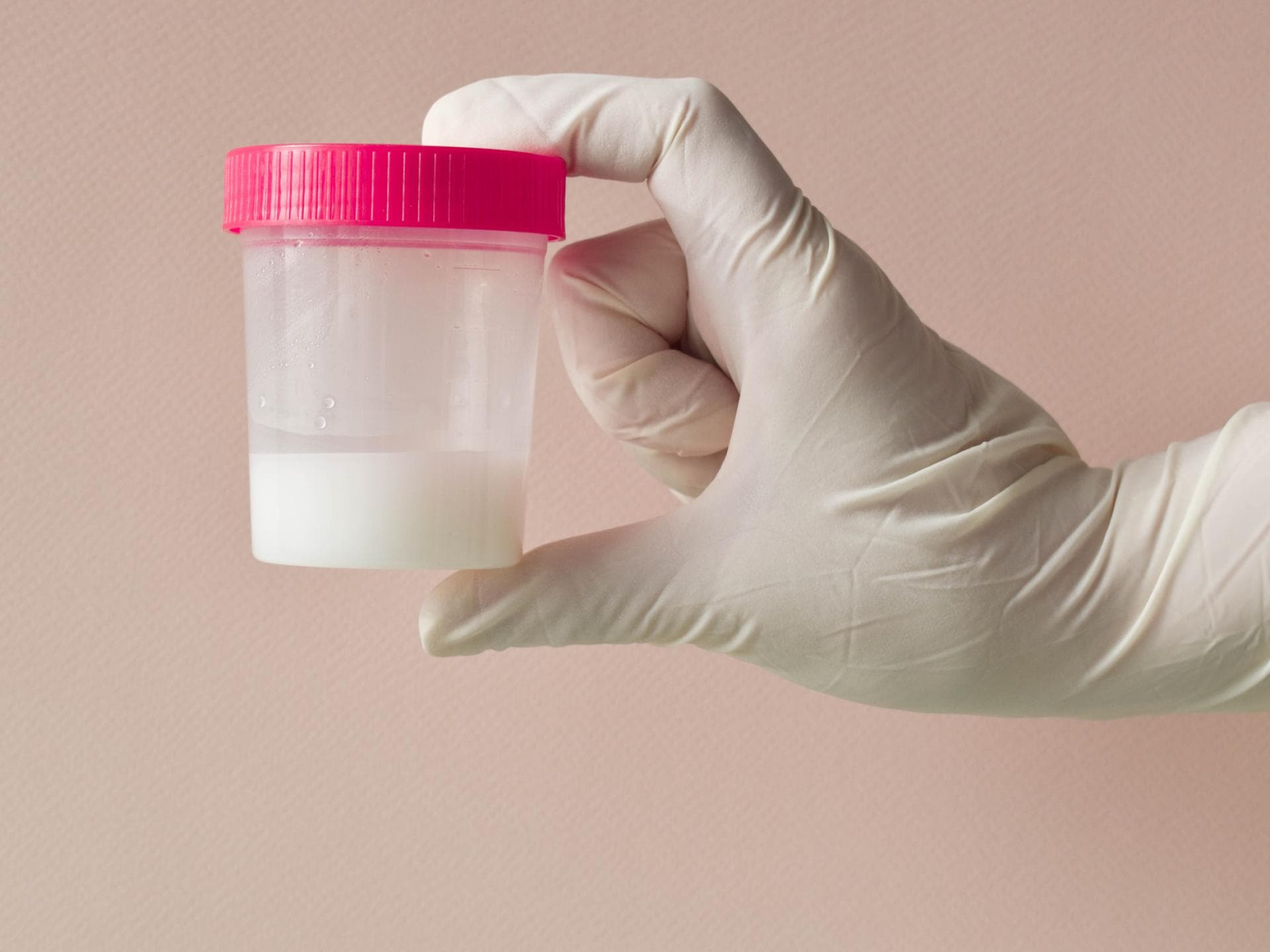 Hand hält Spermaprobe hoch Hand hält Spermaprobe hoch