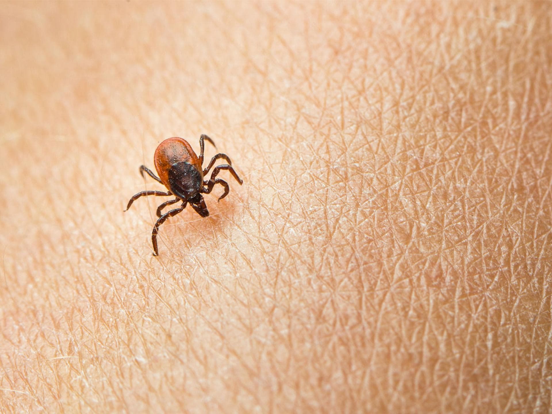 Borreliose vom Biss der Zecke