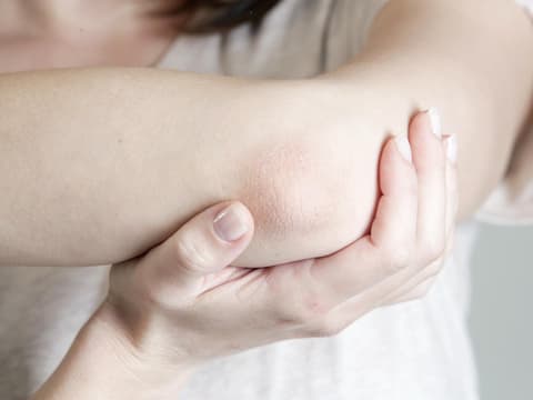 Arm einer Frau