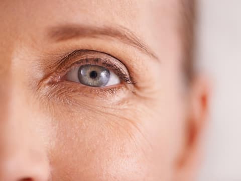 Falten am Augen