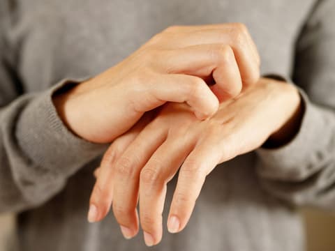 Frau juckt Handrücken