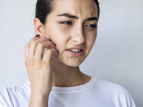 Skin Picking