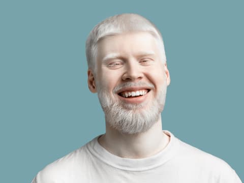 Mann mit Albinismus