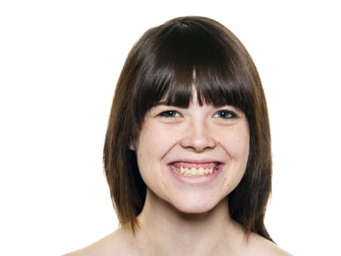 Frau mit Zahnfleischlächeln