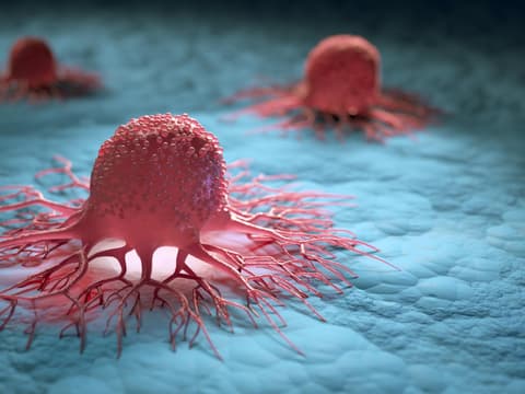 Chemotherapie und Strahlentherapie bekämpfen Darmkrebs-Zellen.