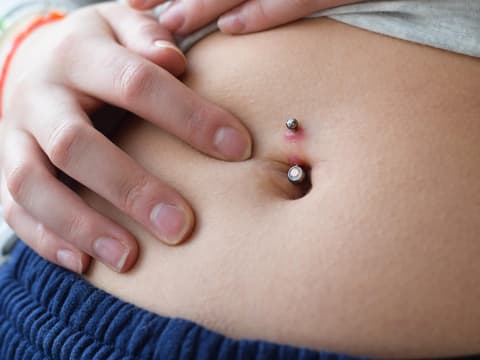 In manchen Fällen kommt es am Piercing zu sogenanntem Wildfleisch.