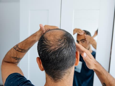 Haarausfall bei Männern hat verschiedene Ursachen