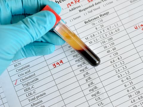 Neue Studien zeigen jedoch, dass zu viel HDL-Cholesterin auch schädlich sein kann.