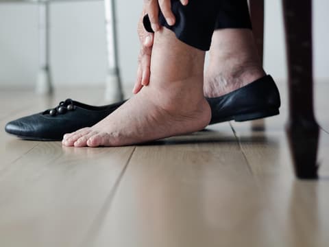 Charcot Fuß
