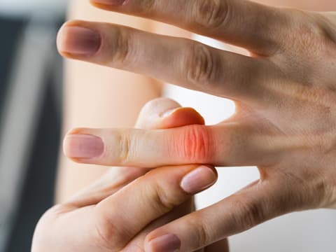 Gicht im Finger