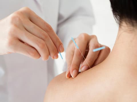 Ärztin steckt Akupunkturnadeln in Nacken einer Patientin
