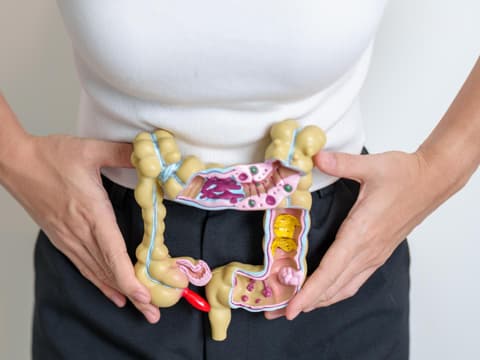 Frau hält ein Modell vom Dickdarm vor ihren Bauch