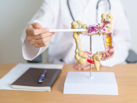Arzt zeigt auf ein Dickdarm-Anatomiemodell