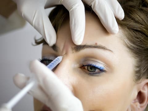 Unterspritzung einer Zornesfalte mit Botox