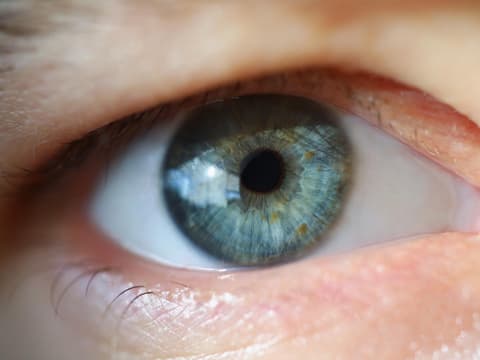 Nahaufnahme eines Auges, bei dem das Augenlid herunter hängt 