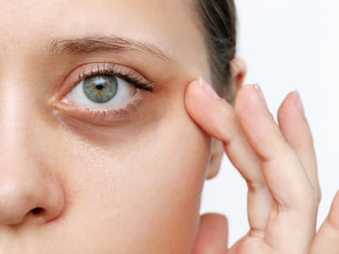 Frau mit dunklen Schatten unter den Augen