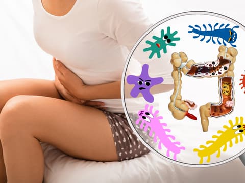 Morbus Crohn