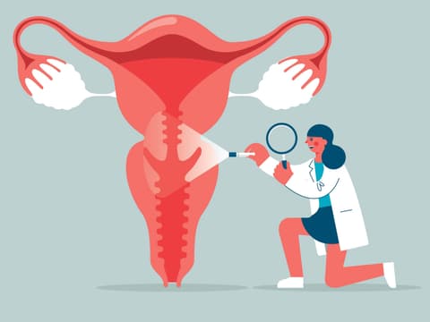 Bei einer Endometriose siedelt sich Gewebe außerhalb der Gebärmutterhöhle ansiedelt.