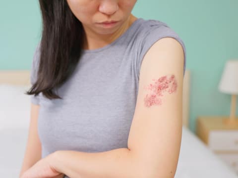 Frau betrachtet Ausschlag am Arm