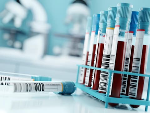 Blutproben im Labor