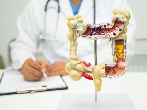 Arzt sitzt vor anatomischem Modell des Darms