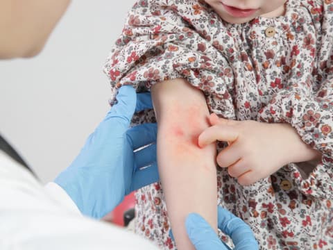 Kind mit Neurodermitis wird von Arzt untersucht