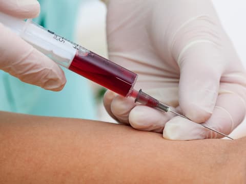 Person bekommt Eigenblut injeziert