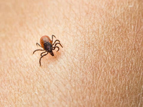 Borreliose vom Biss der Zecke