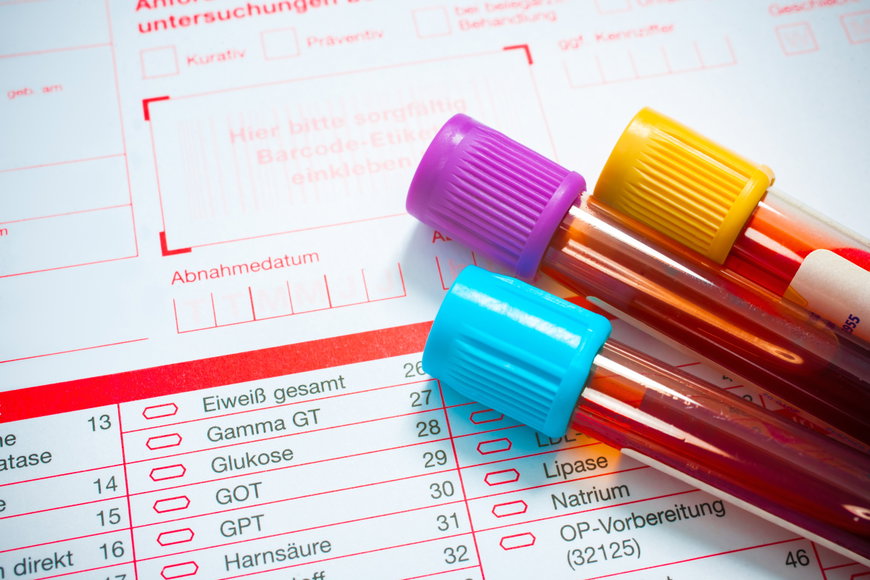 Zu dickes Blut: Ursachen, Symptome und Behandlung