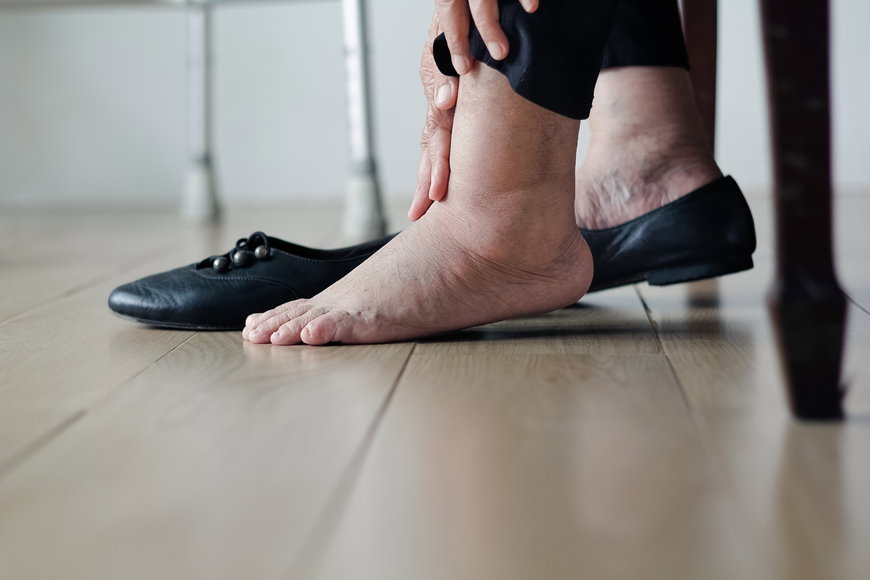 Charcot-Fuß: Was ist das und wer ist gefährdet?