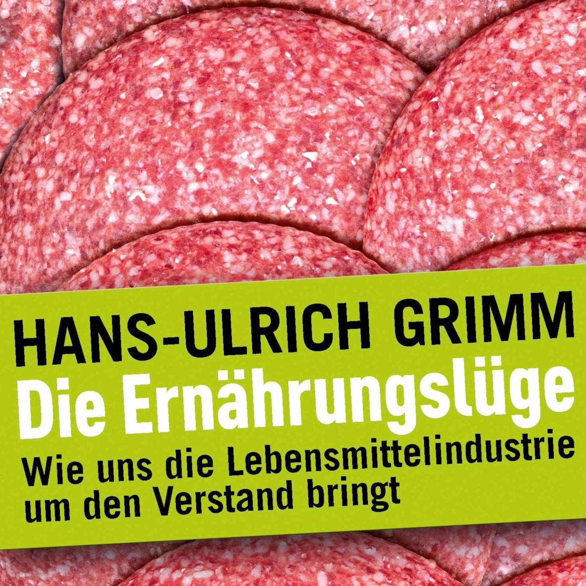 Glutamatunvertraglichkeit Erkennen Und Behandeln