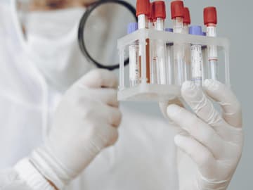 Coronavirus Schadigt Leber Zeigen Bielefelder Forscher