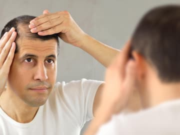 Mann mit Haarausfall Mann mit Haarausfall