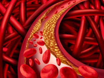 Erhoehtes Cholesterin Erhoehtes Cholesterin