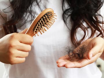 Frau mit Haarausfall Frau mit Haarausfall