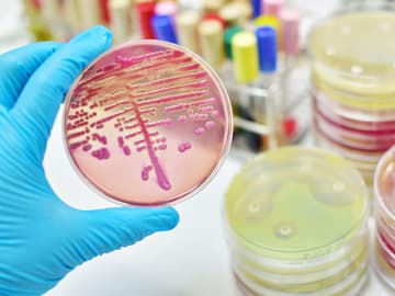Streptokokken Behandlung und Ursachen Streptokokken Behandlung und Ursachen
