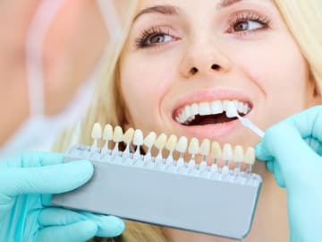 Bleaching-der-Zähne Zähne richtig aufhellen