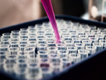 coronatest-labor-laesst-proben-liegen