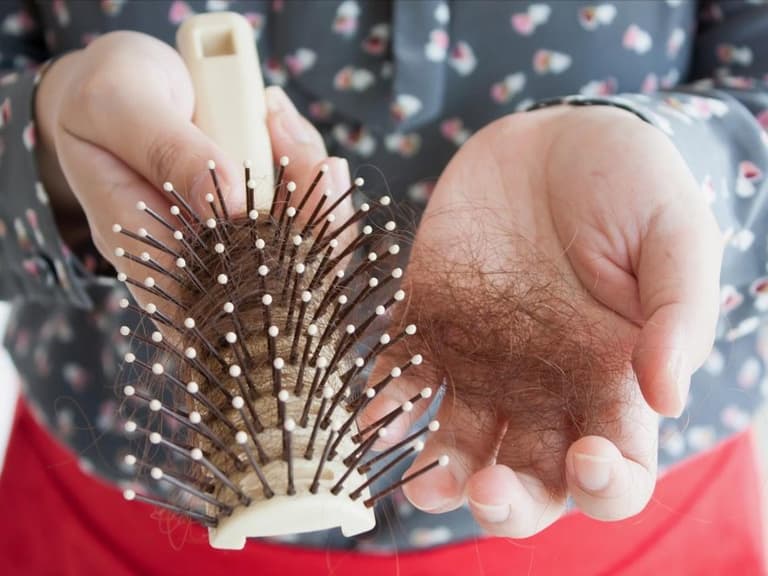 Haarausfall Bei Frauen Diese Therapien Konnen Helfen