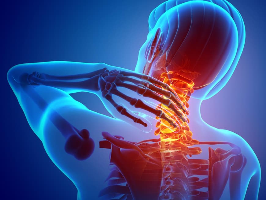 Wie Lange Dauern Schluckbeschwerden Nach Hws Op HWS-Syndrom: Ursachen und Therapie
